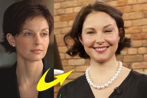 ashley-judd-surgery