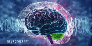 neurotherapy